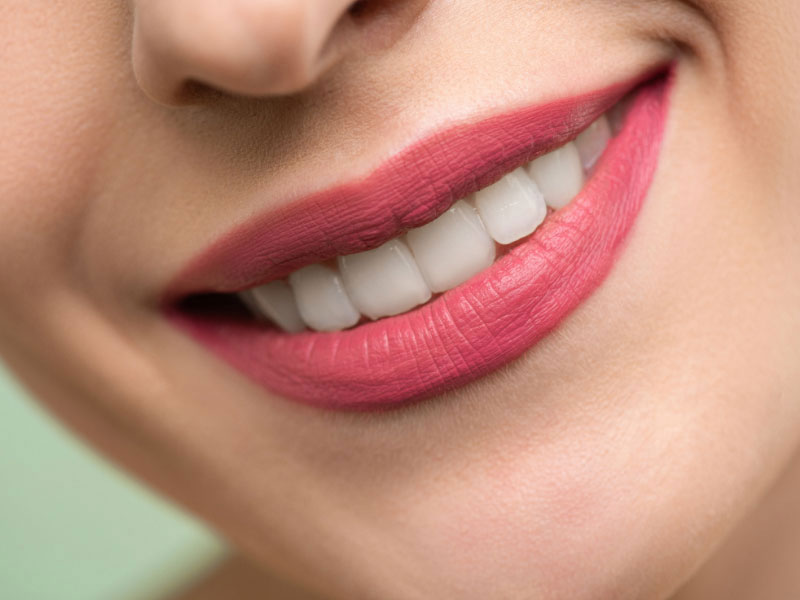 Teeth Whitening Experts